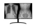Monitor komputerowy LG 32HL512D-B 80 cm 3840 x 2160 px Full HD Czarny - 2439153